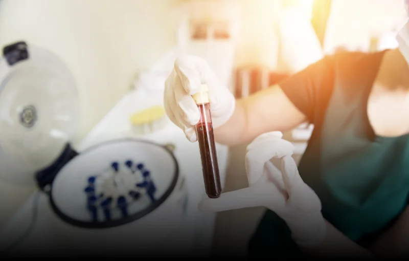 RTG-USG navigovaná autologní plazma