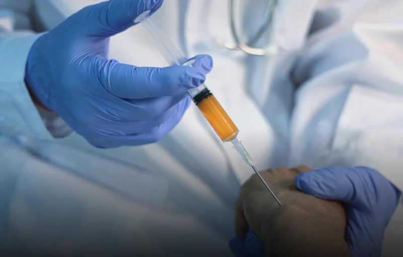 Endoskopické ošetření syndromu karpálního tunelu - home