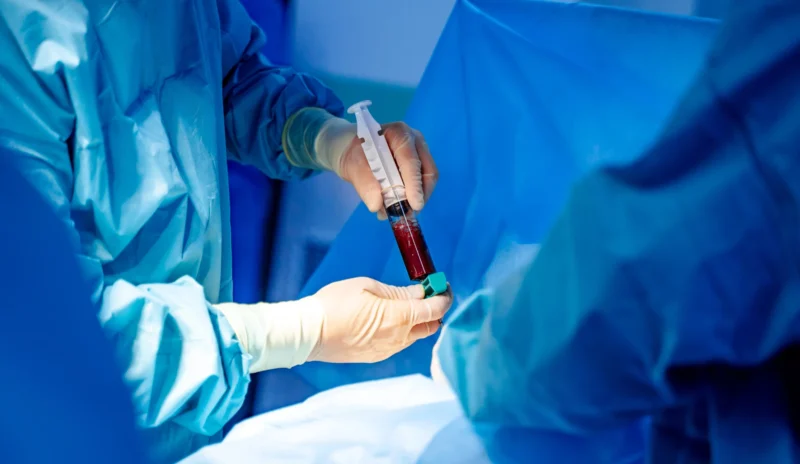 Koncentrát z kostní dřeně (BMAC)