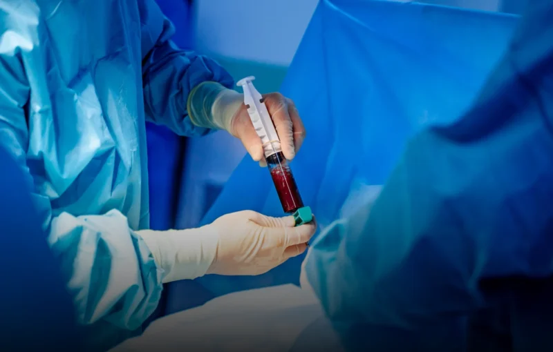 Koncentrát z kostní dřeně (BMAC) - home