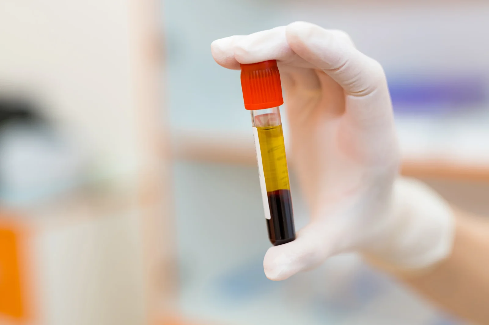 Pro koho je BMAC terapie vhodná