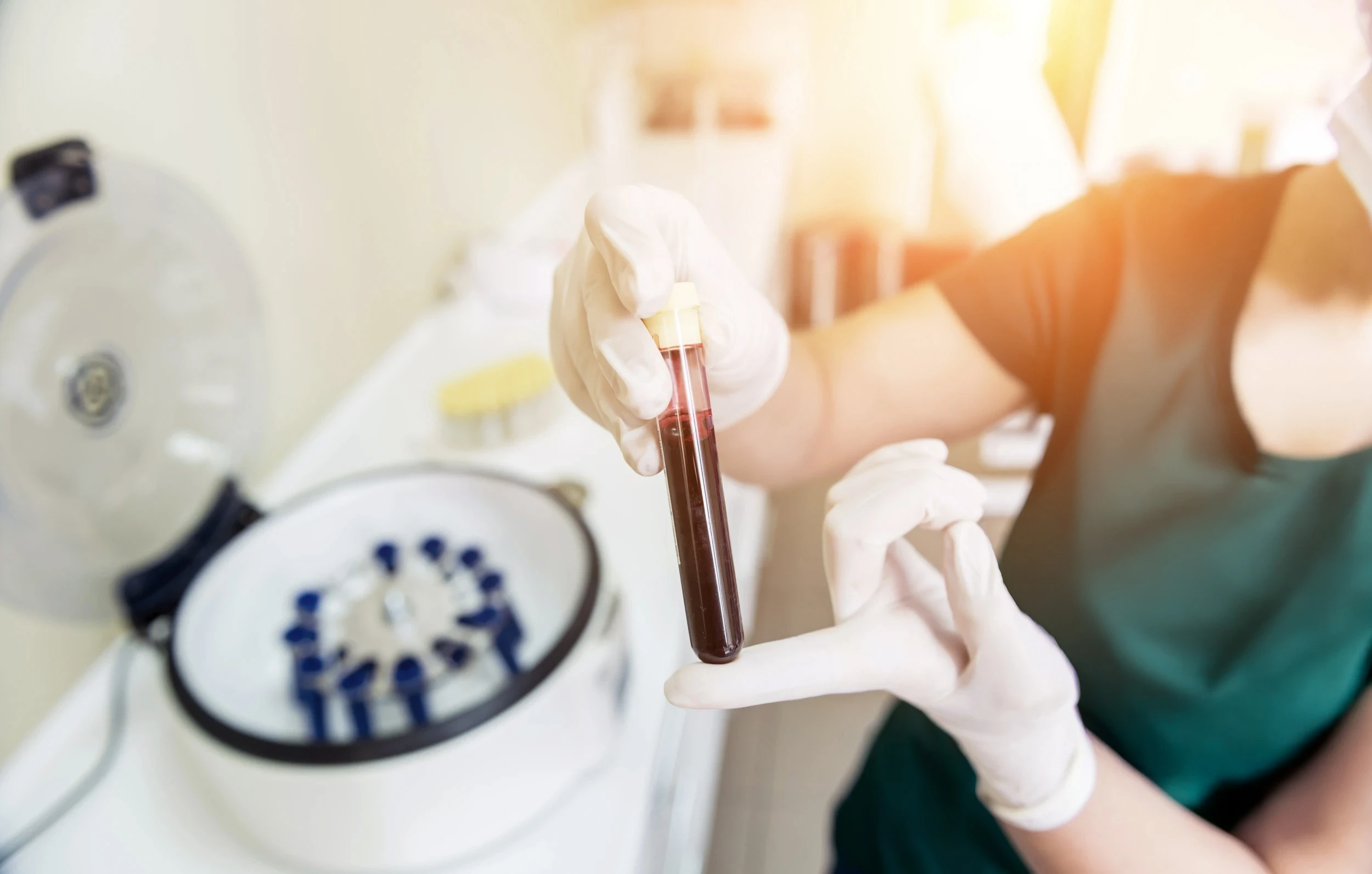 RTG-USG-navigovana-autologni-plazma - terapie RegePain