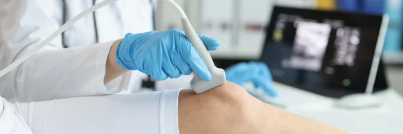 Zpracování a aplikace SVF