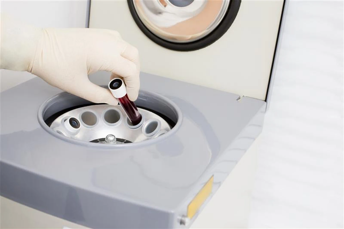 autologní plazma (PRP) a obtíže